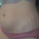 up close to show stretch marks