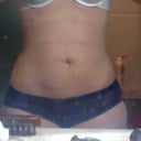 5 days post op abd/hip