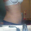 post op day 5 abd/hip