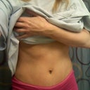 1 week post op
