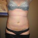 3 days after