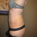3 days after