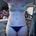 lumpy and swollen :( 8 days after