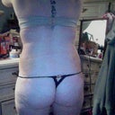 lumpy and swollen :( 8 days after