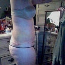lumpy and swollen :( 8 days after