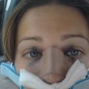 Day of Surgery The thing around my neck is my U-shape pillow haha