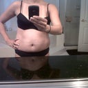 before-front view. Lots of stretch marks and loss skin.