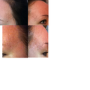 Top  = session 2 day 6 Bottom  = before