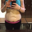 "THE TUM" .... BEFORE - 140 lbs, want to lose another 15 or so before my consult, and reduce my body fat about 10% before the actual procedure.