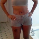 tape burn around bb post op 5 weeks starting to lighten up