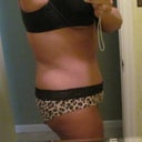 6 week side, you can see how low the swelling is all below my BB