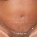 Close up of scar Day 16