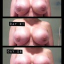 Progression: Weeks 2 - 4