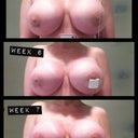 Progression: Weeks 5 - 7