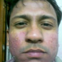 after 10 days