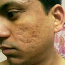 see same pigmentation is there