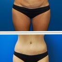 Ok, I know this was just for fun.  But, still you get the idea and can see the difference regardless of scar.