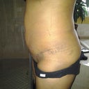 Still swollen though