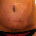 front photo close up on belly button 
almost 4 weeks