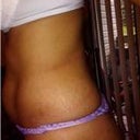 belly side view