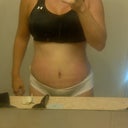 10 or 11 days post op.
