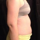 Before - side