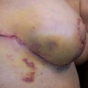 right side view. Lotsand lots of bruising.