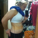 Few hours after Surgery (side view)