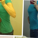 Before and after in same shirt.. A push up bra will help my profile. This is day 5 since explant.