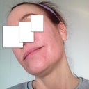 One month later - another inside shot. No makeup. Just moisturizer.