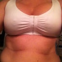 11 days post op