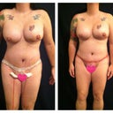 Week 1---Week 2 PO