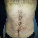 Tummy (sorry for the hair...it's winter and I get cold!)