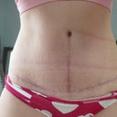 3 1/2 months po