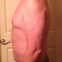 33 day post
