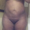 4 days post op