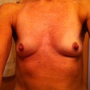 my tiny concave boobs