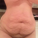 My belly two years after having my twins! Blah