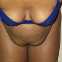 Before-bending