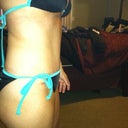 41 days Post op.  So excited about the results!