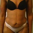 Front (yucky)