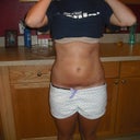 1 week post op