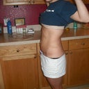 1 week post op