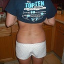 1 week post op