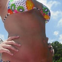 3 weeks post op