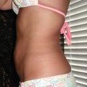 4.5 weeks post op