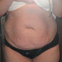 Before- front view
(sorry about the flash)