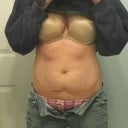 here is a bigger picture of my poor little tummy : ( it really needs some TLC