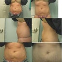 6 photos the top right and mid right is me suckinin to show the bumps above my navel are actually parts of my lower rib cage