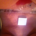 front view sitting- sorry its upside down - 3 days post op